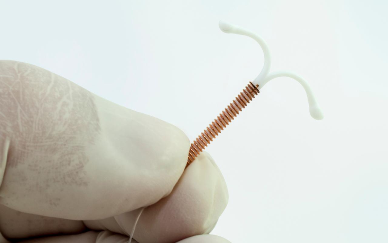 Médico com luva segurando o DIU Mirena.
